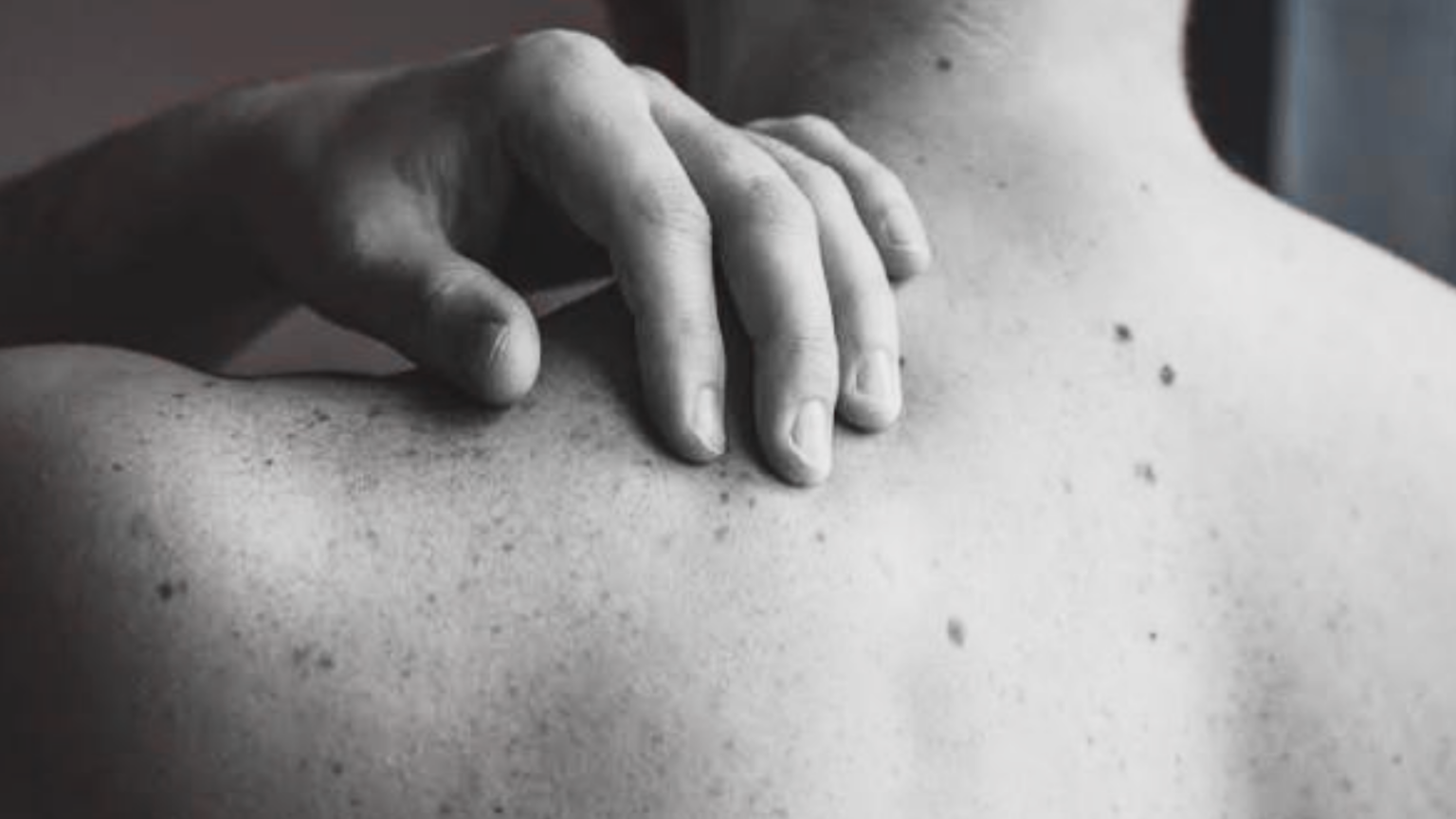 Moderna y Merck anuncian resultados positivos de un tratamiento personalizado contra el melanoma basado en ARN mensajero.