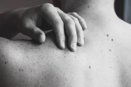 Moderna y Merck anuncian resultados positivos de un tratamiento personalizado contra el melanoma basado en ARN mensajero.